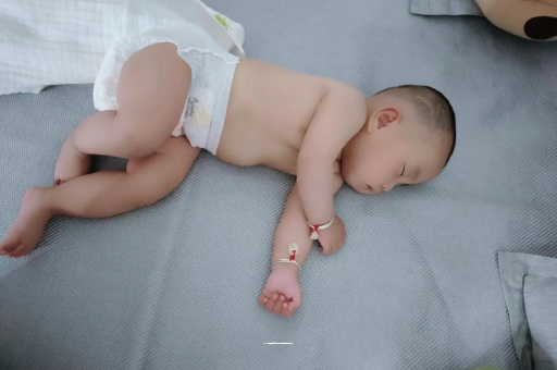 昌乐宝宝褶皱处擦粉还是油